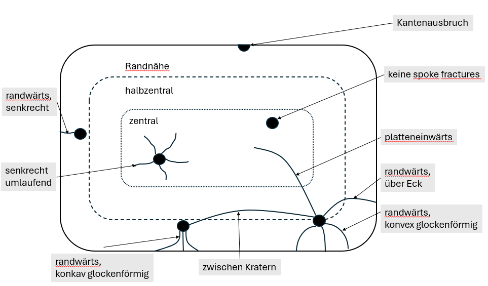 Statistische Auswertung spoke fractures